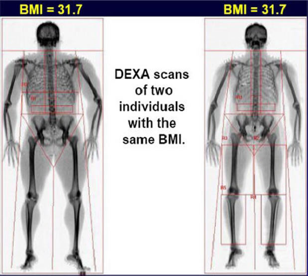 Why I think BMI  is  BS!